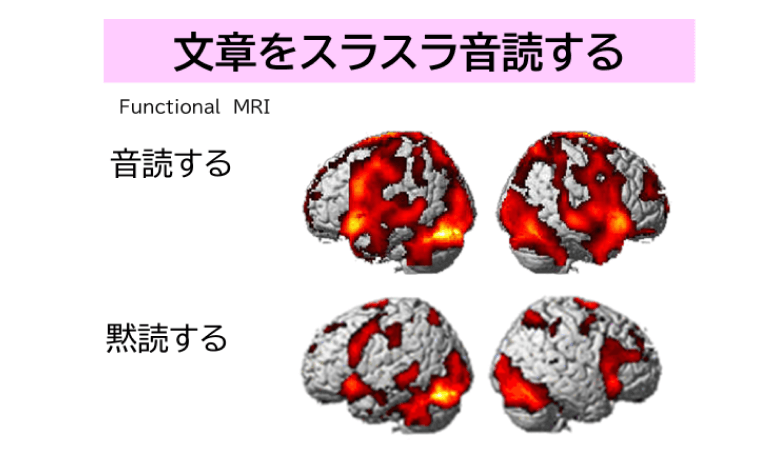 「簡単な計算をスラスラ解くこと」「文章をスラスラ音読すること」が、脳全体を活性化する2